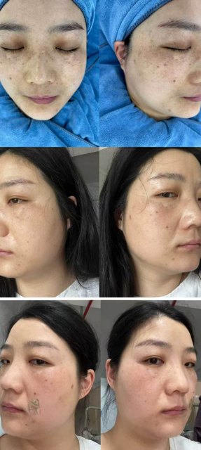 2026护肤避坑指南：一眼看穿“夸大其词”的美容宣传，别再交“智商税”了！封面